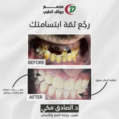 حالة قبل وبعد العلاج
