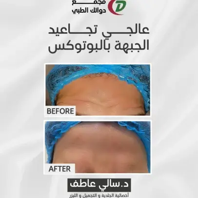حالة قبل وبعد العلاج