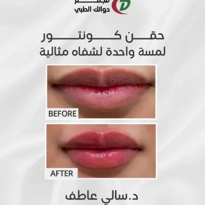 حالة قبل وبعد العلاج