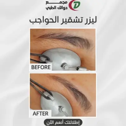 حالة قبل وبعد العلاج